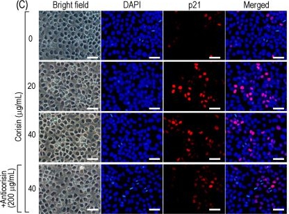 Fig.5.C showing Immunocytochemistry-immunofluorescence in a Homo sapiens (Human) sample from the publication: Microbiota-Derived Corisin Is Elevated in Early Cervical Neoplasia and Drives Pathogenic Cellular Programs.