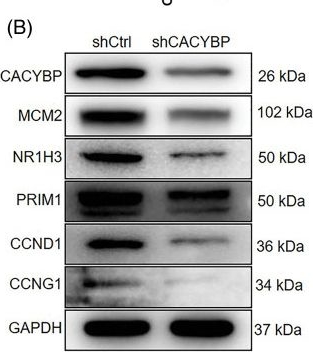 Fig.4.B showing Western Blotting in a Homo sapiens (Human) sample from the publication: Calcyclin-binding protein contributes to cholangiocarcinoma progression by inhibiting ubiquitination of MCM2.