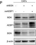 Fig.6.P showing Western Blotting from the publication: BGN/MDK Axis in the Melanoma Tumor Microenvironment Strengthens Tumor Malignancy by Modulating Cancer Cells and Cancer-Associated Fibroblasts Crosstalk.