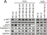 Fig.5.A showing Western Blotting from the publication: A novel system-level approach using RNA-sequencing data identifies miR-30-5p and miR-142a-5p as key regulators of apoptosis in myocardial infarction.