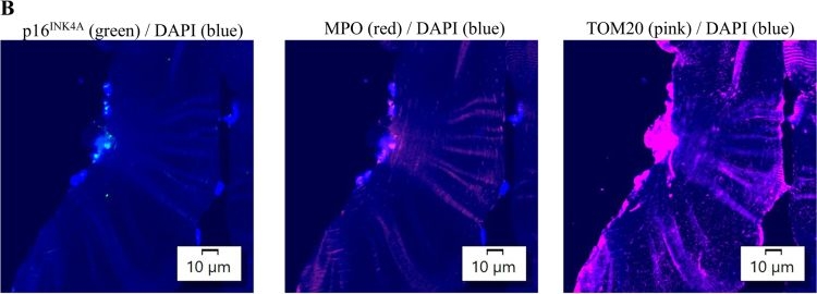 Fig.5.B showing Immunohistochemistry-immunofluorescence in a Homo sapiens (Human) sample from the publication: Anti-inflammatory effects of nicotinamide mononucleotide (NMN) in human skeletal muscle after BFR-exercise.