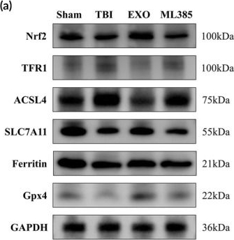 Fig.8.A showing Western Blotting from the publication: Olfactory ensheathing cells exosomes enhance neurological recovery in brain-injured rats by modulating Nrf2-ferroptosis pathway.