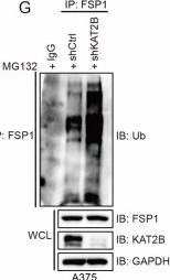 Fig.4.G showing Western Blotting in a Homo sapiens (Human) sample from the publication: SLC25A1 and ACLY maintain cytosolic acetyl-CoA and regulate ferroptosis susceptibility via FSP1 acetylation.