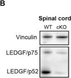Fig.1.B showing Western Blotting in a Mus musculus (House mouse) sample from the publication: Absence of Ledgf in mouse brain affects the Kmt2a/b and polycomb balance, synaptic transmission and motor function.