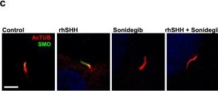 Fig.5.C showing Immunocytochemistry-immunofluorescence in a Homo sapiens (Human) sample from the publication: Ligand-dependent hedgehog signaling maintains an undifferentiated, malignant osteosarcoma phenotype.