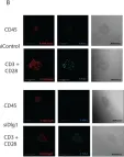 Fig.1.B showing Immunocytochemistry-immunofluorescence from the publication: Disc Large Homolog 1 Is Critical for Early T Cell Receptor Micro Cluster Formation and Activation in Human T Cells.