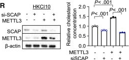 Fig.5.R showing Western Blotting from the publication: METTL3 drives NAFLD-related hepatocellular carcinoma and is a therapeutic target for boosting immunotherapy.