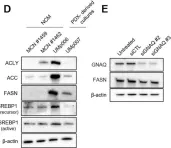 Fig.1.D showing Western Blotting from the publication: Co-Targeting FASN and mTOR Suppresses Uveal Melanoma Growth.