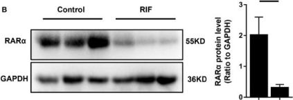 RARα (E6Z6K) Rabbit mAb | Cell Signaling Technology