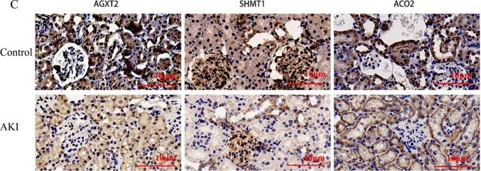 Fig.5.C showing Immunohistochemistry in a Rattus norvegicus (Rat) sample from the publication: Identification of AGXT2, SHMT1, and ACO2 as important biomarkers of acute kidney injury by WGCNA.