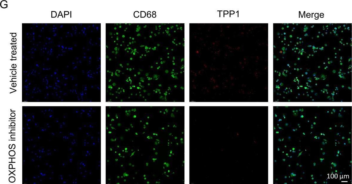 Fig.7.G showing Immunocytochemistry-immunofluorescence from the publication: Prognostic implications of high- OXPHOS macrophages in gastric cancer: a single-cell transcriptomics and tumor microenvironment communication study.