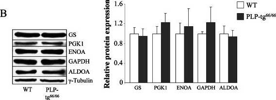 Fig.4.B showing Western Blotting in a Mus musculus (House mouse) sample from the publication: Oxidative stress and mitochondrial dynamics malfunction are linked in Pelizaeus-Merzbacher disease.