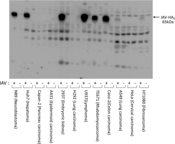 Fig.1.A showing Western Blotting in a Homo sapiens (Human) sample from the publication: Enterokinase Enhances Influenza A Virus Infection by Activating Trypsinogen in Human Cell Lines.
