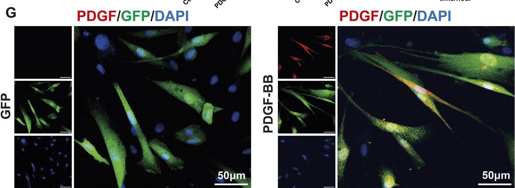 Fig.2.G showing Immunocytochemistry-immunofluorescence from the publication: PDGF-BB overexpressing dental pulp stem cells improve angiogenesis in dental pulp regeneration.