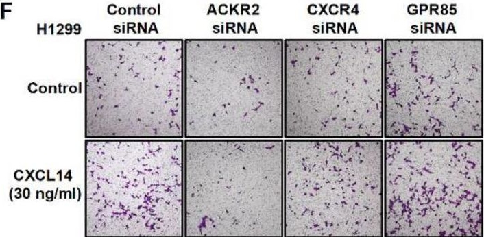 Fig.3.F showing Immunohistochemistry in a Homo sapiens (Human) sample from the publication: CXCL14 promotes metastasis of non-small cell lung cancer through ACKR2-depended signaling pathway.