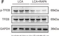 Fig.5.F showing Western Blotting in a Mus musculus (House mouse) sample from the publication: Low Shear Stress Promotes Atherosclerosis by Mediating Pathological Accumulation of Endothelial Lipid Droplets via the KLF4/TFEB/ATP1A1 Axis.