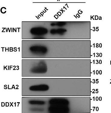 Fig.5.C showing Western Blotting from the publication: HBx Mediated Increase of DDX17 Contributes to HBV-Related Hepatocellular Carcinoma Tumorigenesis.