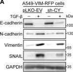 Fig.3.A showing Western Blotting from the publication: Opposing USP19 splice variants in TGF-β signaling and TGF-β-induced epithelial-mesenchymal transition of breast cancer cells.