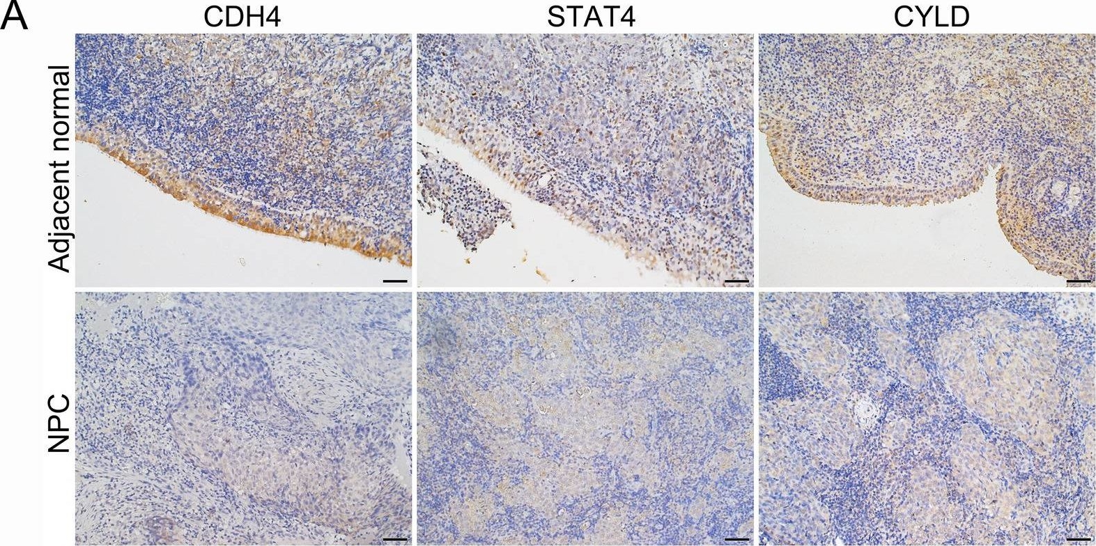 Fig.4.A showing Immunohistochemistry from the publication: A 3-gene signature comprising CDH4, STAT4 and EBV-encoded LMP1 for early diagnosis and predicting disease progression of nasopharyngeal carcinoma.