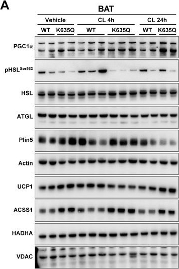Fig.3.A showing Western Blotting from the publication: β3-adrenergic receptor agonist causes acute thermogenic metabolic crisis in ACSS1-K635Q knock-in mice.