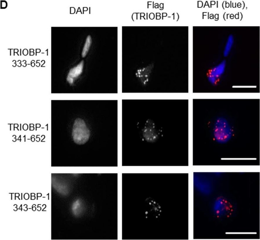Fig.3.D showing Immunocytochemistry-immunofluorescence from the publication: TRIOBP-1 Protein Aggregation Exists in Both Major Depressive Disorder and Schizophrenia, and Can Occur through Two Distinct Regions of the Protein.