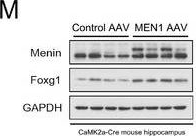 Fig.2.M showing Western Blotting in a Mus musculus (House mouse) sample from the publication: Menin Deficiency Induces Autism-Like Behaviors by Regulating Foxg1 Transcription and Participates in Foxg1-Related Encephalopathy.