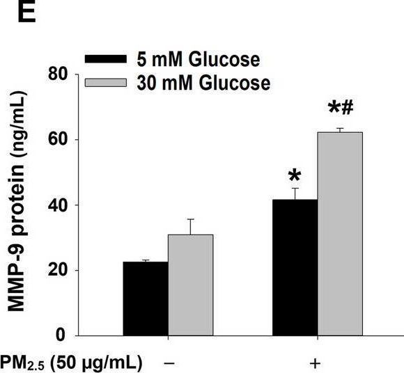 Fig.10.E showing Enzyme-linked immunosorbent assay from the publication: High glucose enhances the activation of NLRP3 inflammasome by ambient fine particulate matter in alveolar macrophages.