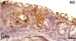 Fig.5.N showing Immunohistochemistry in a Mus musculus (House mouse) sample from the publication: hnRNP I regulates neonatal immune adaptation and prevents colitis and colorectal cancer.