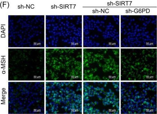 Fig.4.F showing Immunocytochemistry-immunofluorescence in a Homo sapiens (Human) sample from the publication: Mechanism of desuccinylation of G6PD mediated by SIRT7 to promote vitiligo disease progression.