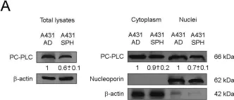 Fig.4.A showing Western Blotting from the publication: Inhibition of Phosphatidylcholine-Specific Phospholipase C Interferes with Proliferation and Survival of Tumor Initiating Cells in Squamous Cell Carcinoma.