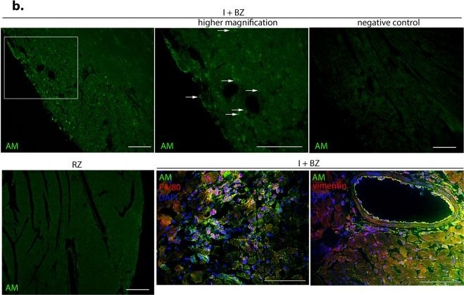 Hepatokine α1-Microglobulin Signaling Exacerbates Inflammation and Disturbs Fibrotic Repair in Mouse Myocardial Infarction.