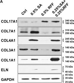 Fig.3.A showing Western Blotting in a Homo sapiens (Human) sample from the publication: In Vitro Anti-Aging Effects of Yeast/Rice Fermentation Filtrate Combined with Sialic Acid in Cosmetic Applications.
