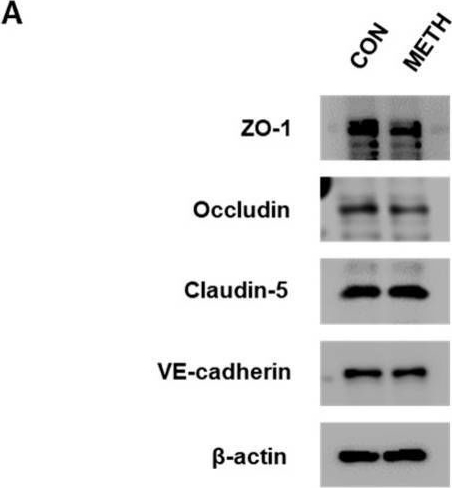 Fig.2.A showing Western Blotting from the publication: Involvement of RhoA/ROCK Signaling Pathway in Methamphetamine-Induced Blood-Brain Barrier Disruption.