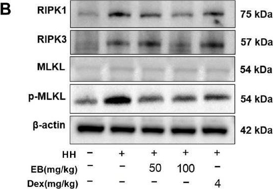 Fig.4.B showing Western Blotting in a Rattus norvegicus (Rat) sample from the publication: Eleutheroside B Ameliorates Cardiomyocytes Necroptosis in High-Altitude-Induced Myocardial Injury via Nrf2/HO-1 Signaling Pathway.