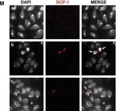 Fig.6.M showing Immunocytochemistry-immunofluorescence in a Drosophila melanogaster (Fruit fly) sample from the publication: Tumor suppressor function of SHMT in a Drosophila RasV12DlgRNAi model: DNA damage and synergistic gene-nutrient interaction with PLP.