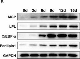 Fig.2.B showing Western Blotting from the publication: MGP regulates the adipogenic differentiation of mesenchymal stem cells in osteoporosis via the Ca2+/CaMKII/RIP140/FABP3 axis.