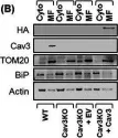 Fig.7.B showing Western Blotting from the publication: Caveolin-3 deficiency associated with the dystrophy P104L mutation impairs skeletal muscle mitochondrial form and function.