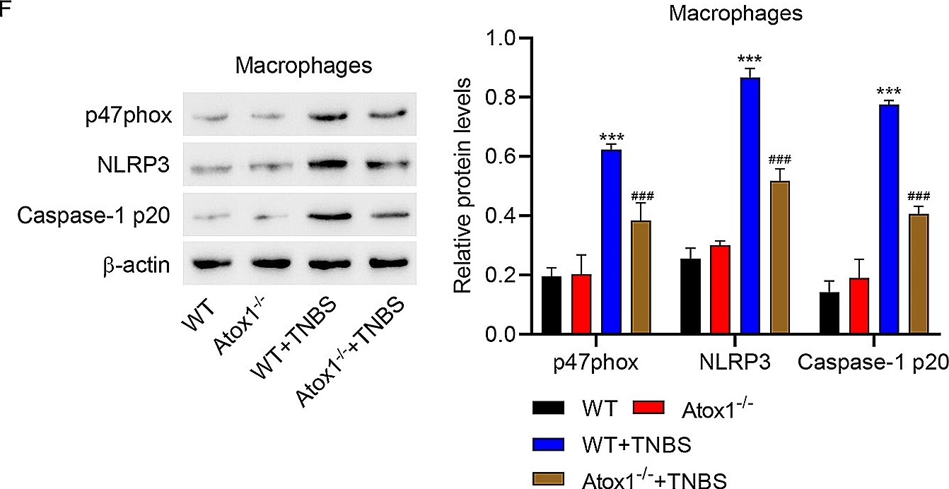 Fig.6.F showing Western Blotting in a Mus musculus (House mouse) sample from the publication: Atox1 regulates macrophage polarization in intestinal inflammation via ROS-NLRP3 inflammasome pathway.