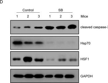 Fig.7.D showing Western Blotting in a Homo sapiens (Human) sample from the publication: Role of heat shock protein 70 in silibinin-induced apoptosis in bladder cancer.