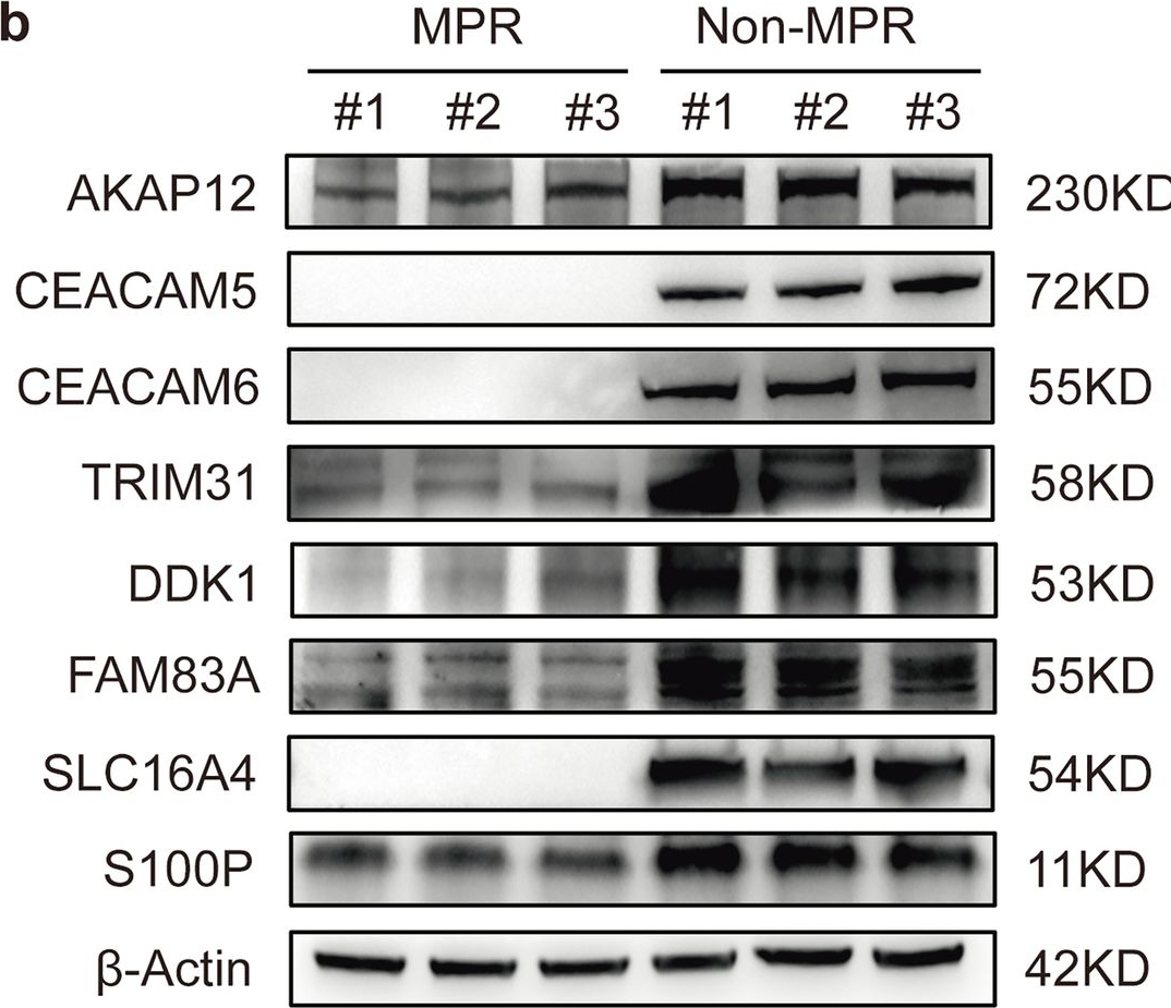 Fig.8.B showing Western Blotting in a Homo sapiens (Human) sample from the publication: Integrative analysis reveals prognostic value of cuproptosis and copper hemostasis related genes in immunotherapy for non-small cell lung cancer.
