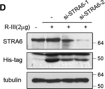 Fig.3.D showing Western Blotting in a Rattus norvegicus (Rat) sample from the publication: Fusion protein of retinol-binding protein and albumin domain III reduces liver fibrosis.