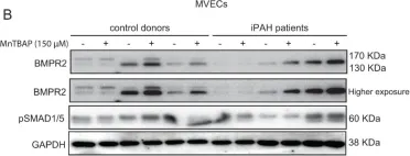 Fig.3.B showing Western Blotting from the publication: MnTBAP Reverses Pulmonary Vascular Remodeling and Improves Cardiac Function in Experimentally Induced Pulmonary Arterial Hypertension.