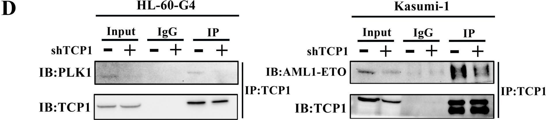 Fig.3.D showing Western Blotting from the publication: The Molecular Chaperone TCP1 Affects Carcinogenicity and Is a Potential Therapeutic Target for Acute Myeloid Leukemia.