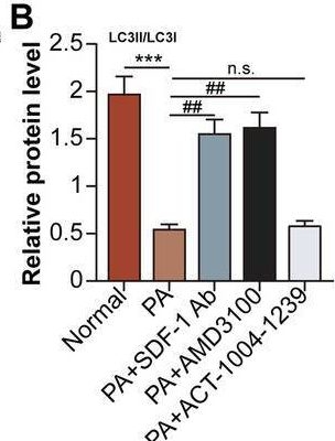 Fig.5.B from the publication: Stromal Cell Derived Factor-1 Promotes Hepatic Insulin Resistance via Inhibiting Hepatocyte Lipophagy.
