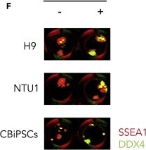 Fig.1.F showing Immunocytochemistry-immunofluorescence from the publication: Human pluripotent stem cell-derived DDX4 and KRT-8 positive cells participate in ovarian follicle-like structure formation.