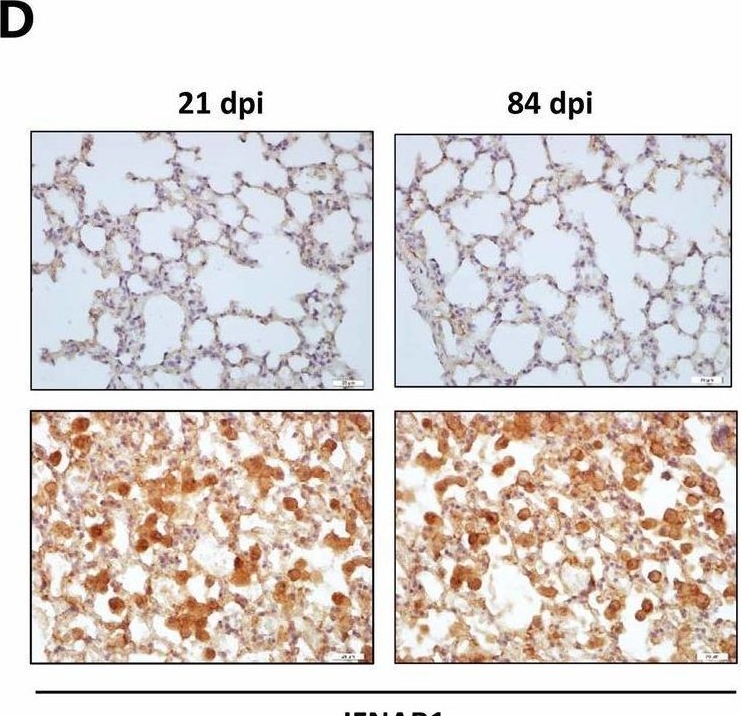 Fig.1.D showing Immunohistochemistry from the publication: Inhibition of type I interferon signaling abrogates early Mycobacterium bovis infection.