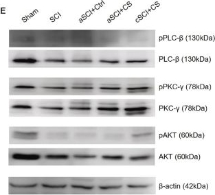 Fig.1.E showing Western Blotting from the publication: Effects of chemogenetic virus injection and clozapine administration in spinal cord injury.