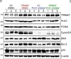 Fig.8.F showing Western Blotting from the publication: TRIM47-facilitated PLK1 stabilization promotes the proliferation of liver cancer cells.