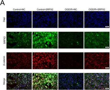 Fig.4.A showing Immunocytochemistry-immunofluorescence from the publication: SRPX2 exhibits neuroprotective effects in neural stem cells: inhibition of OGD/R-stimulated apoptosis and oxidative stress.