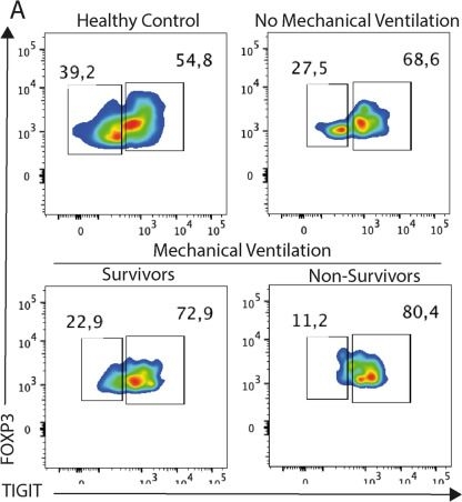 Fig.2.A showing Flow cytometry/Cell sorting in a Homo sapiens (Human) sample from the publication: The TIGIT+ T regulatory cells subset associates with nosocomial infection and fatal outcome in COVID-19 patients under mechanical ventilation.